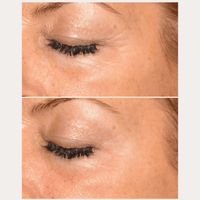 Thumbnail for Smoothing Anti-Aging Set