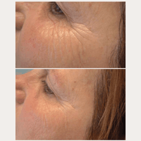 Thumbnail for Smoothing Anti-Aging Set